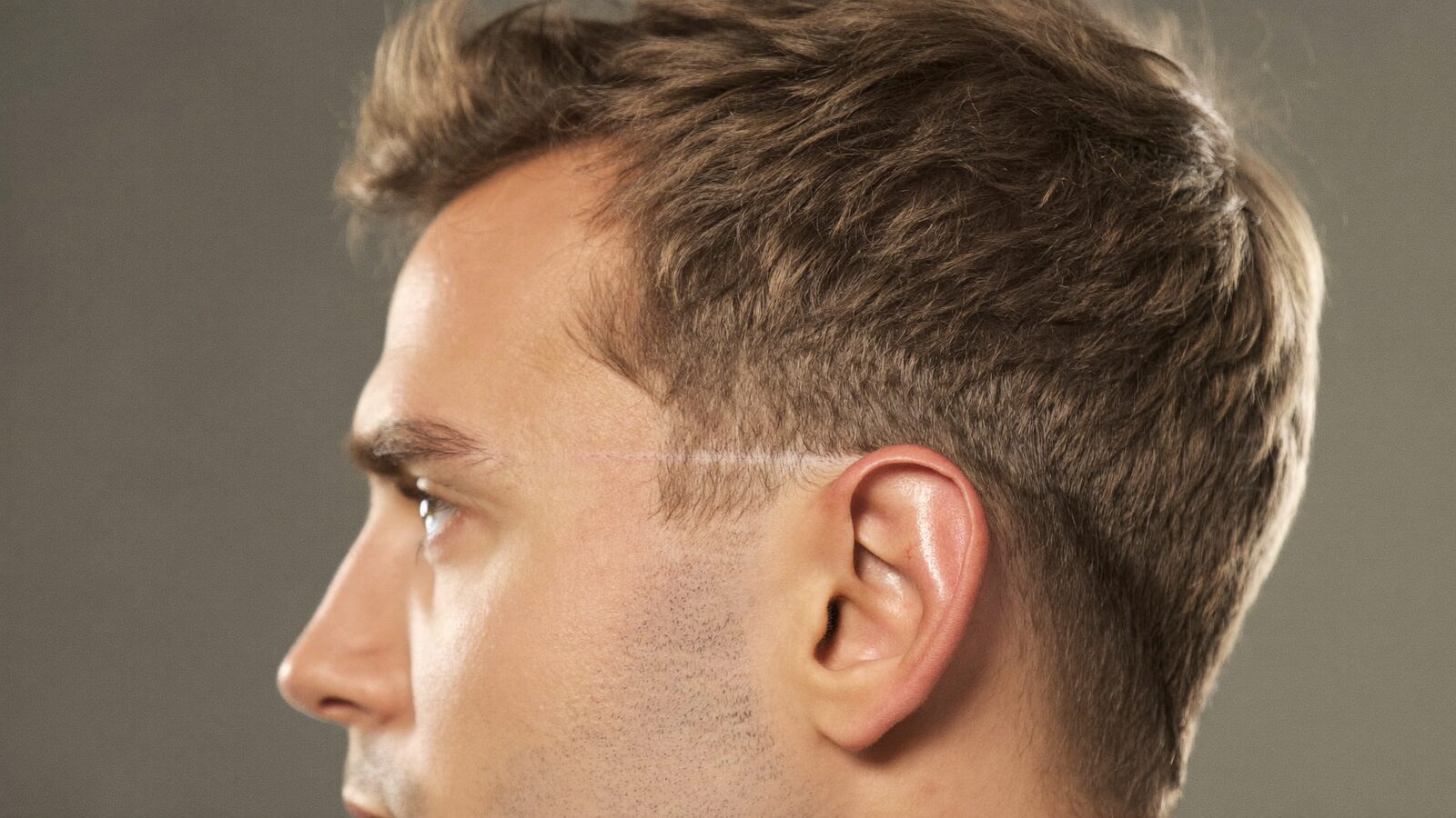 Side profile of a man with short brown hair showing a natural temple line